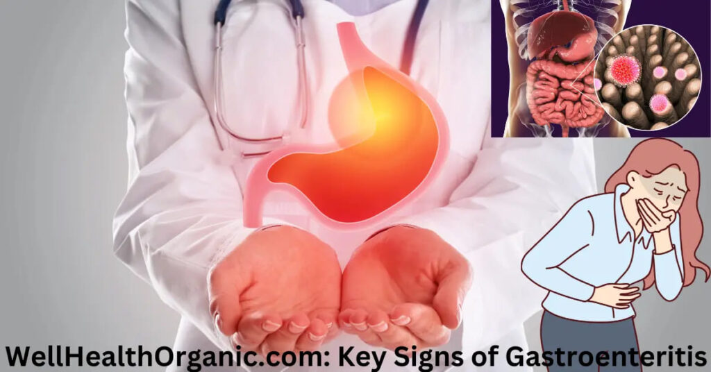 Wellhealthorganic.com: Key signs of Gastroenteritis WellHealthOrganic.com Key Signs of Gastroenteritis